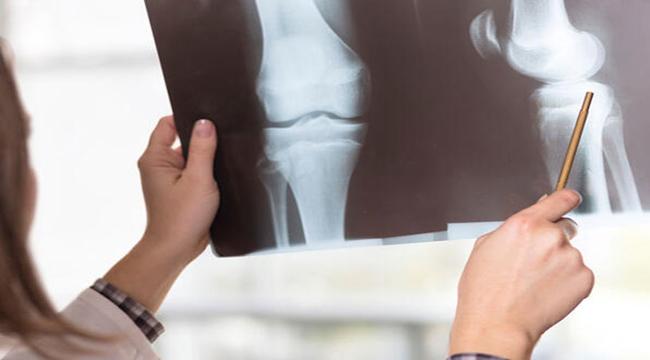 Hareketsizlik Kemiklerimizi Güçsüzleştiriyor